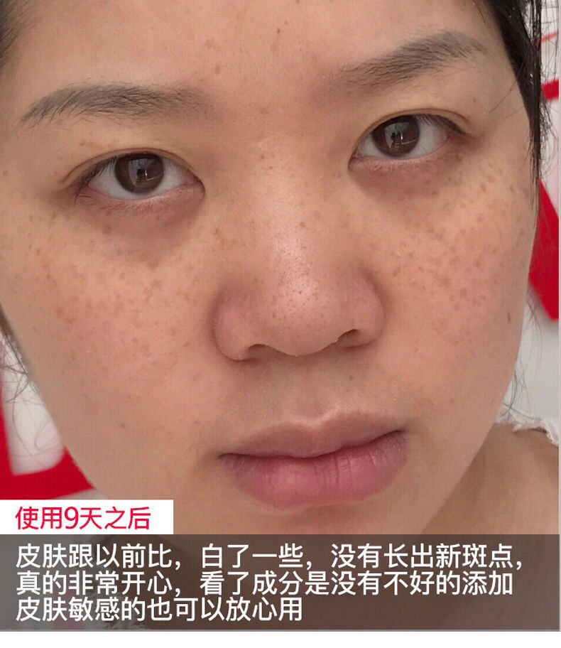 丽邦素百消斑生物美白祛斑美容霜套装雀斑黄褐斑老年斑日晒斑遗传百消