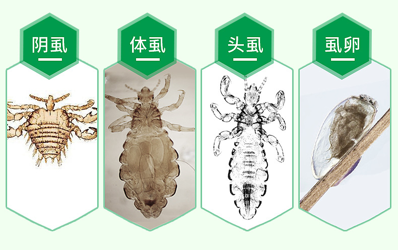 虱疥一扫光30ml虱子药儿童头虱子虱立净除阴虱净喷剂去虱卵成人小女孩