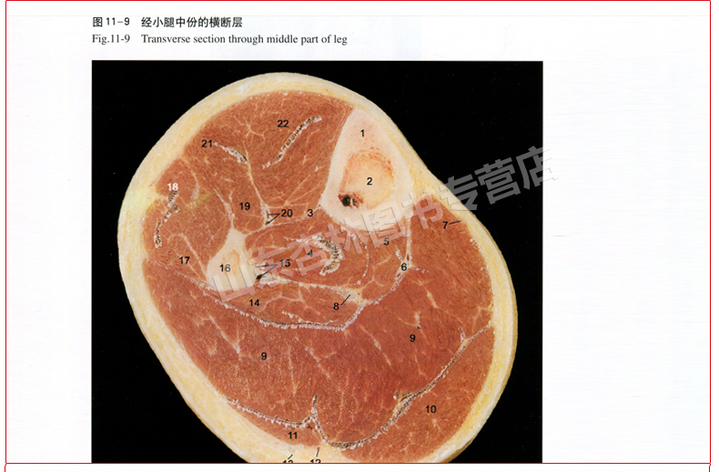 正版人体断层解剖学图谱刘树伟ctmri断层解刨影像彩色插图学习参考书