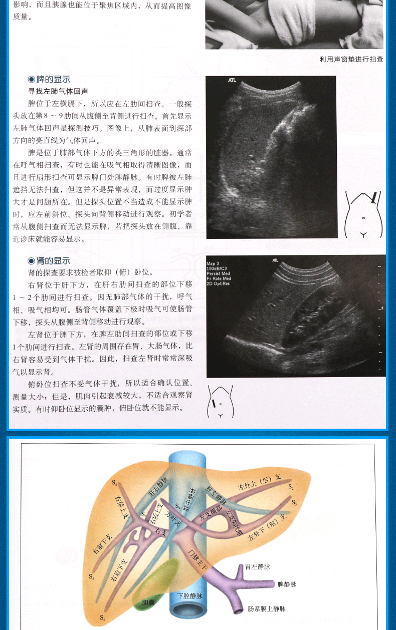 [醉染正版]第3版 腹部超声精细讲解切面解剖 扫查方法与疾病解读 中文