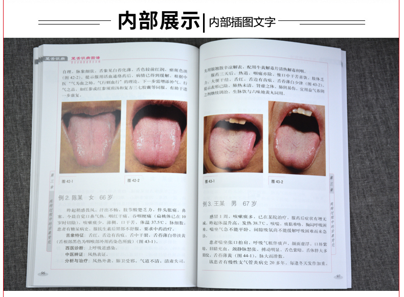 棣人民卫生出版社图解舌诊中医舌诊书籍舌像舌苔舌像望舌诊病彩色图解