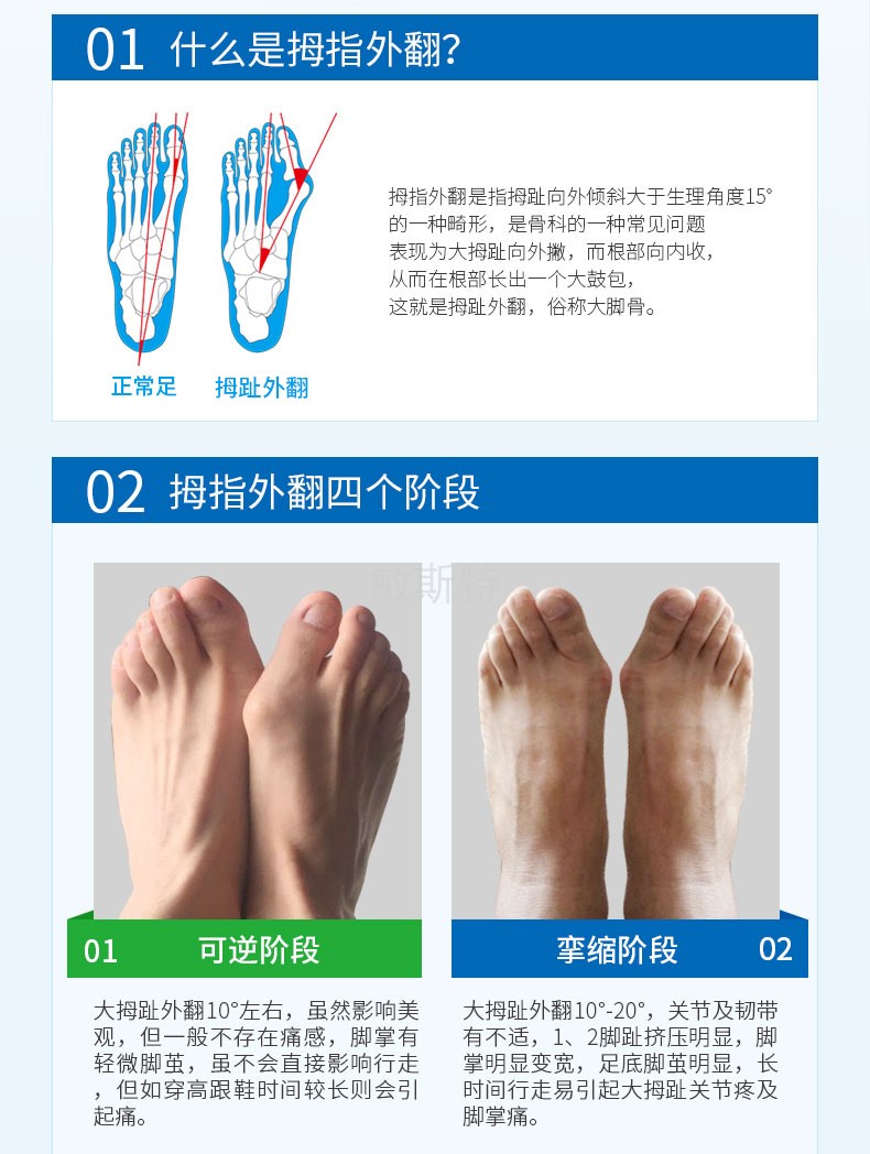 敏斯特大拇指外翻矫正伸张带脚趾外翻脚骨锻炼带矫正器分趾拉力带
