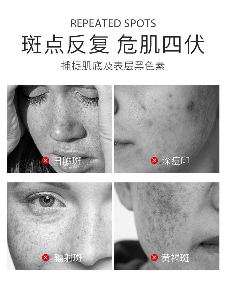 15g支淡斑笔15g淡斑霜滋润保湿色斑褐斑点斑笔提亮肤色