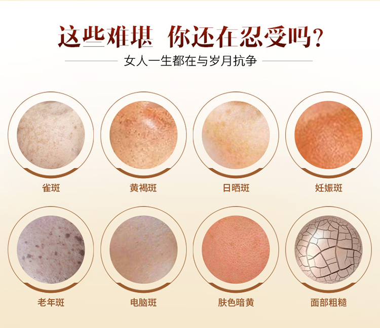 祛斑霜去斑淡斑产品色斑褐斑雀斑晒斑女面霜