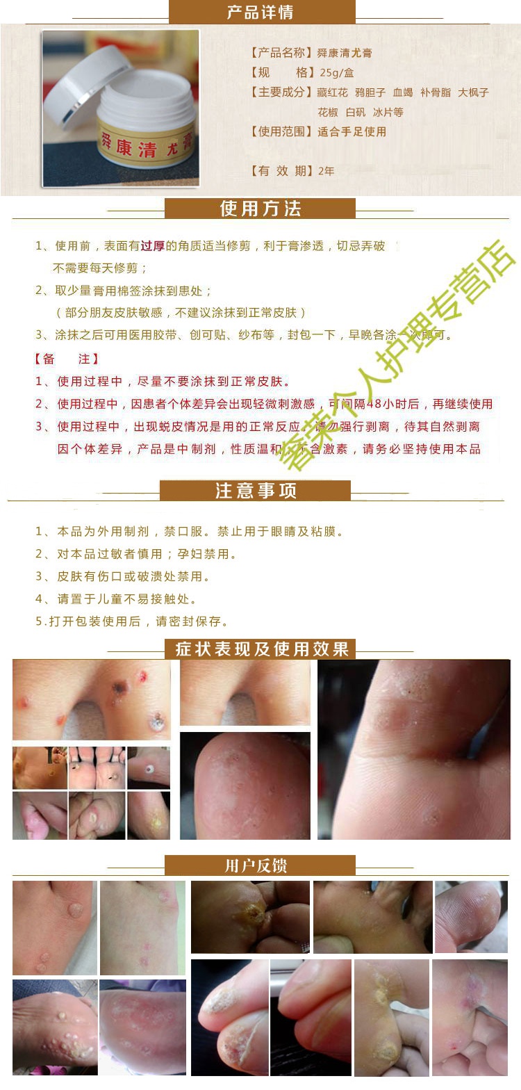 舜康清疣膏无痛祛除跖疣肉刺甲周尤跖尤膏足尤舜康清优膏