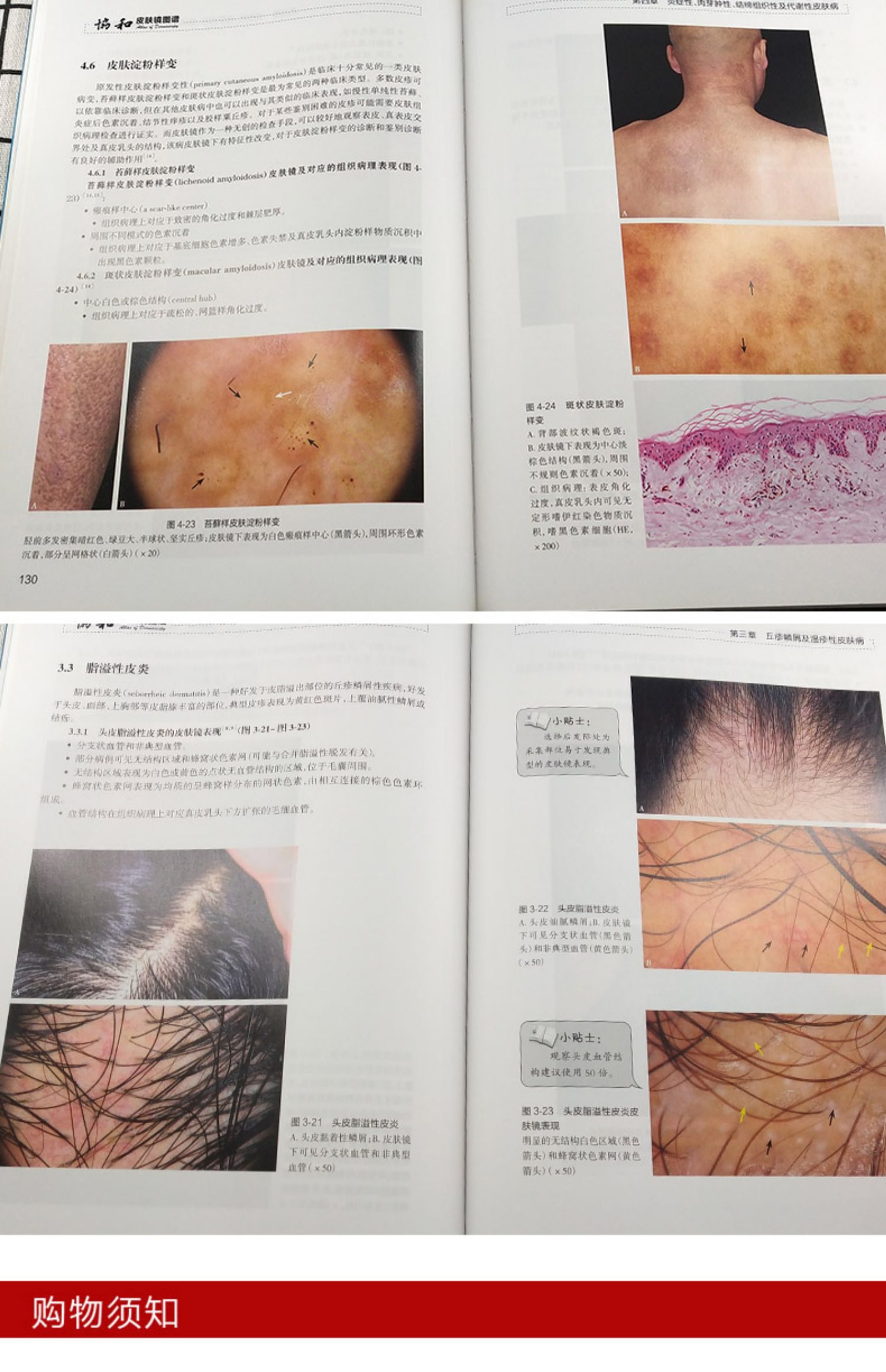 【正版新书】正版 协和皮肤镜图谱 主编 孙秋宁 刘浩 皮肤性病学医生