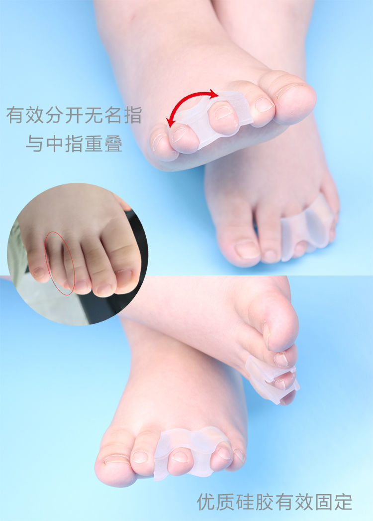 儿童脚趾中指食指重叠第三趾弯曲小拇指内外翻可穿鞋分趾器sn2822