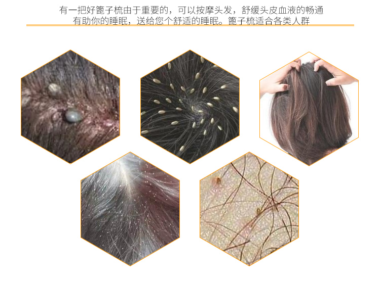 抖音家用芦荟刮胶神器刮梳去虱卵加密梳子篦子虱子梳儿童刮头虮子12把