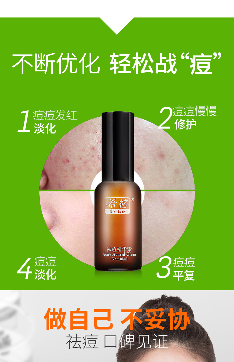 苏宁优选希格痘螨净祛痘精华素去痘痘青春痘黑头粉刺祛痘精华液产品