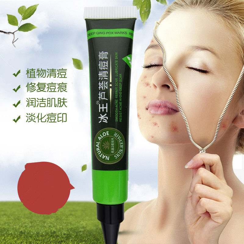 《【2送1】冰王芦荟清痘膏20g祛痘粉刺青春痘男女痘印修复霜抑菌膏》