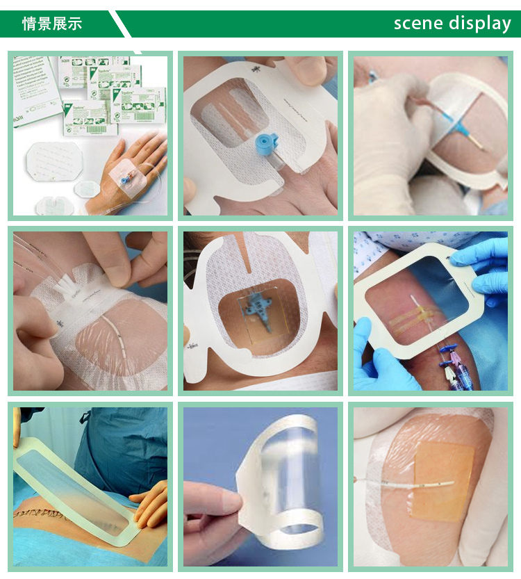 3m 敷料贴透明防水静脉留置针picc置管护理1624/1626w褥疮烧伤贴q