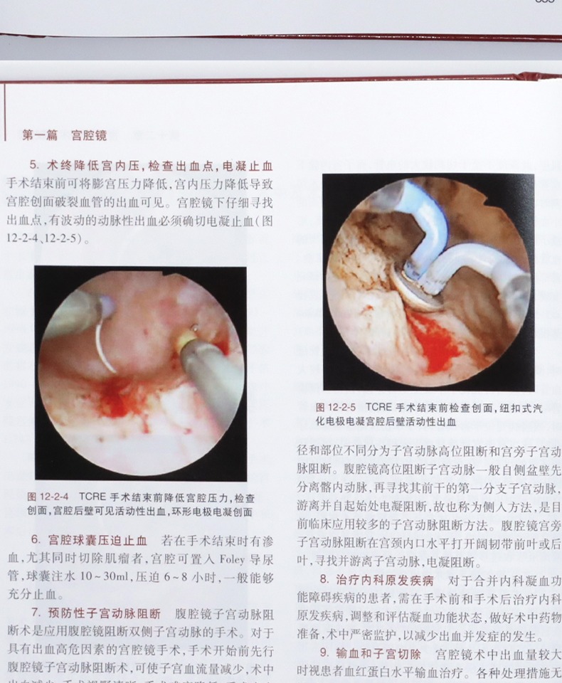 產科手術學腹腔鏡宮腔鏡手術圖譜視頻陰道鏡學人民衛生出版社婦產科腔