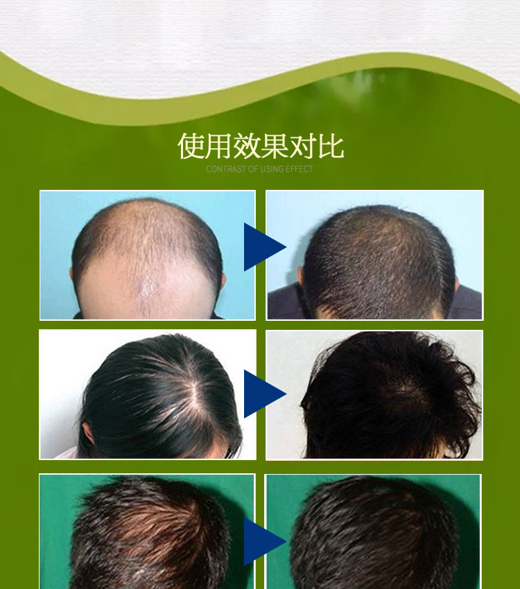 米雅诗防脱发洗发水浓密黑发滋润顺滑秀发增发止痒去屑养护发质
