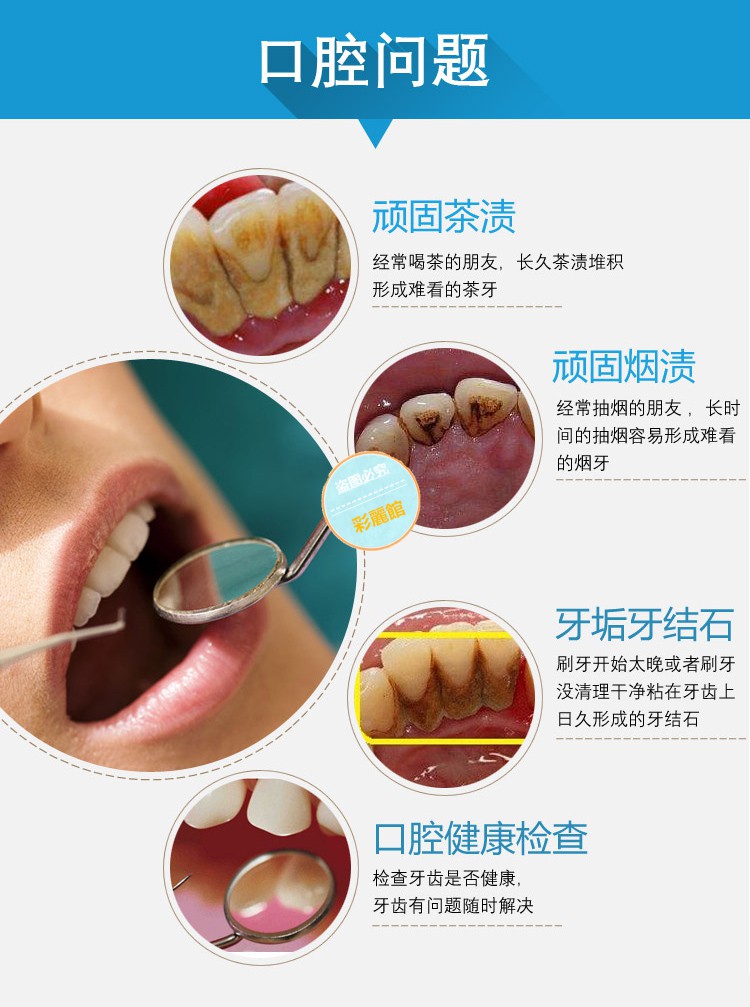 林檎牙结石去除器家用牙石牙垢清洁洗牙器牙镜牙签304不锈钢剔牙工具