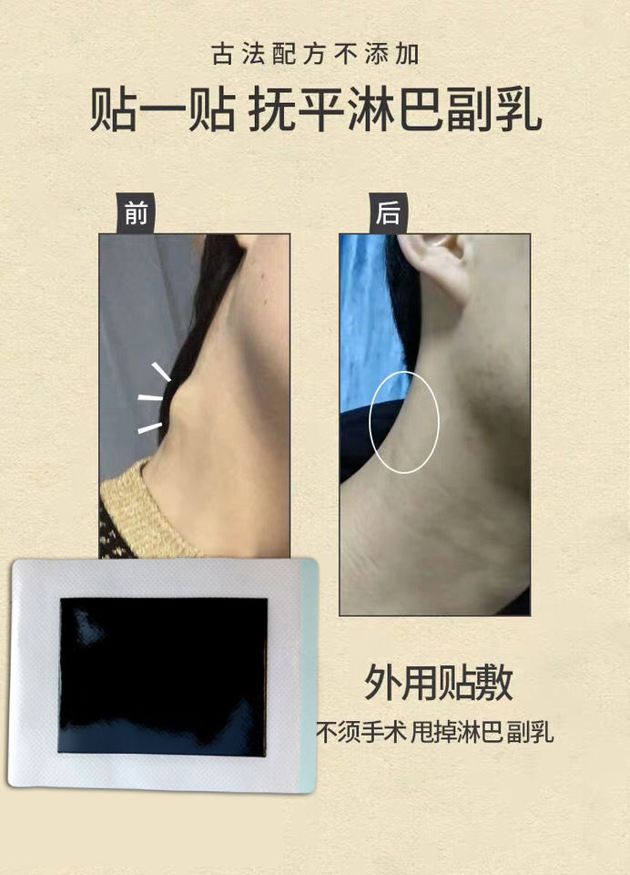 万人验证副乳消贴腋下消副乳神器疏通淋巴结肿大散结贴膏副乳贴1盒10