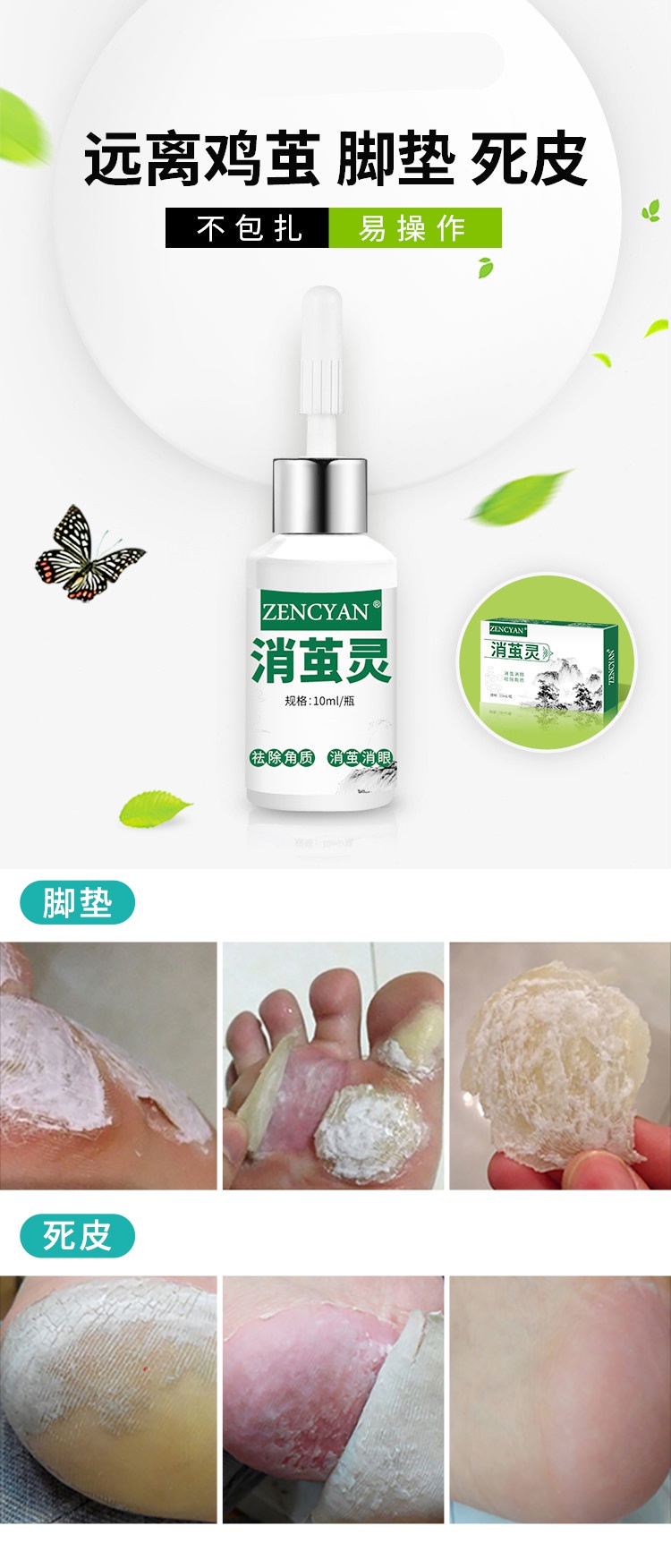 滴茧王清茧灵去除老茧脚茧软化剂脚底脚垫茧子乐擦剂膏贴消茧灵