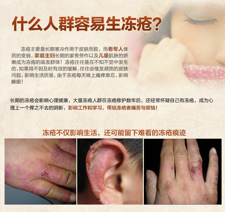冻疮膏防冻膏止痒去手脚冬季冻伤防裂防干燥防皲裂护手霜女 3支(无另)
