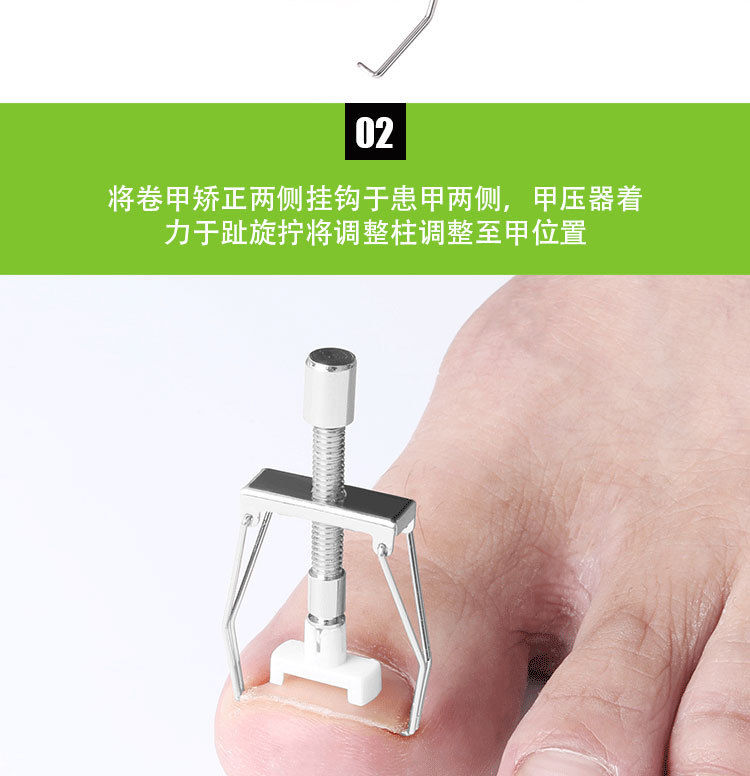 嵌甲矫正器甲沟修脚趾甲卷甲纠正器肉包甲指甲钳灰指甲炎专用工具金色