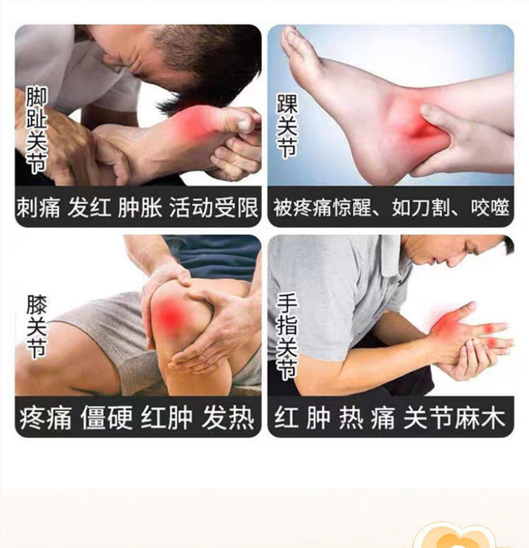 虎头蜂舒经止痛膏去风湿关节炎骨痛变形肿痛僵硬手脚麻木膝盖疼痛实发