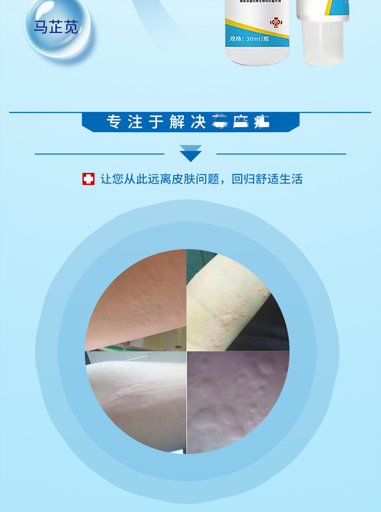 加丹3号卫洛康状肤宁双效组合套装蛇盘疮后遗症带状疱疹神经痛喷剂