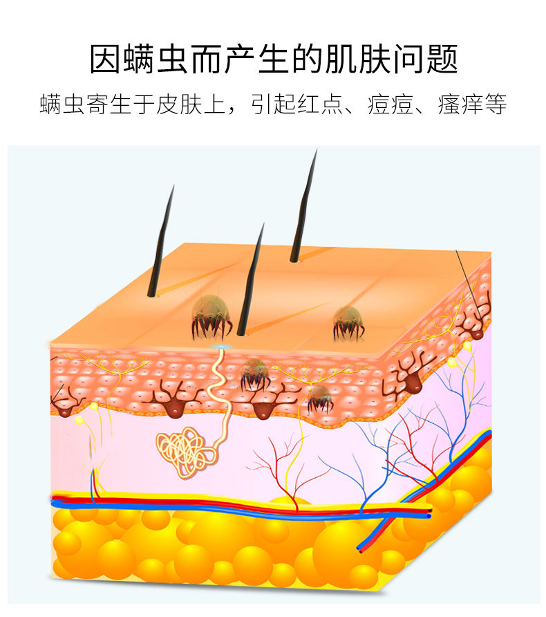 透蜜海盐除螨皂精华液10ml套装净螨祛痘去黑头温和控