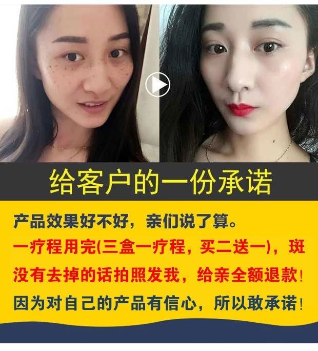 索芙特美白祛斑霜黄褐斑遗传雀斑晒斑老年斑兰皙淡斑祛斑霜索芙特美白