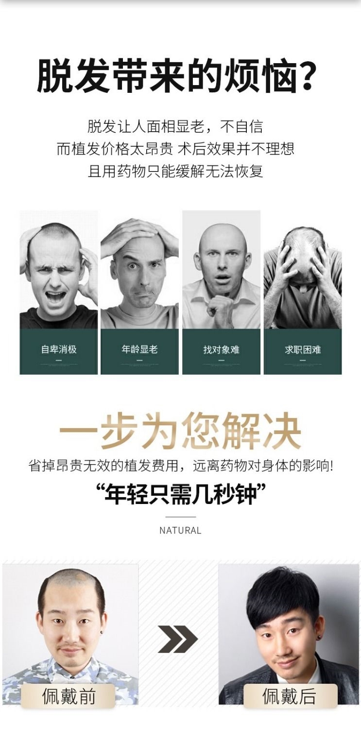 你那么美假发假发男中老年短发帅气韩版男士假发头顶补发块真发前额秃顶假发片你那么美黑色直 真发补发块 价格图片品牌报价 苏宁易购苏享尚品美妆工具专营店