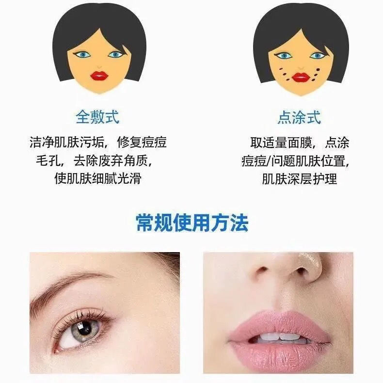 水杨酸面膜超分子刷酸祛痘淡化痘印去粉刺美白补水官方博乐达裸瓶1支