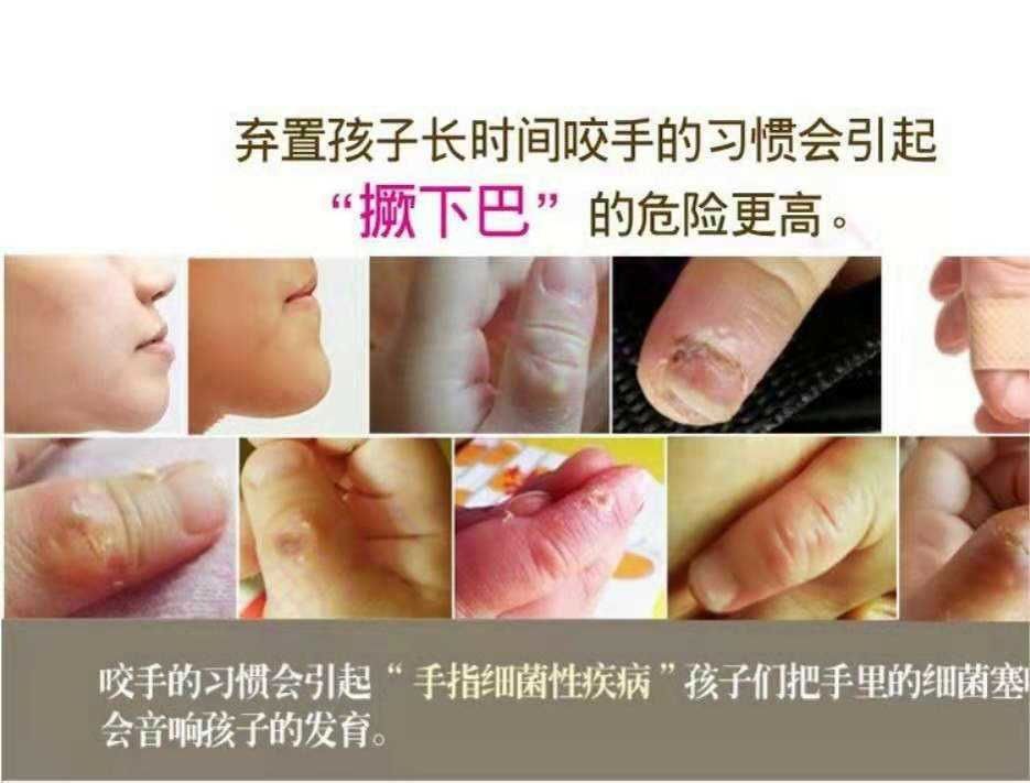 学生防吃手戒咬指甲神器青少年啃手指矫正护指套透气触屏灵敏成人咖啡