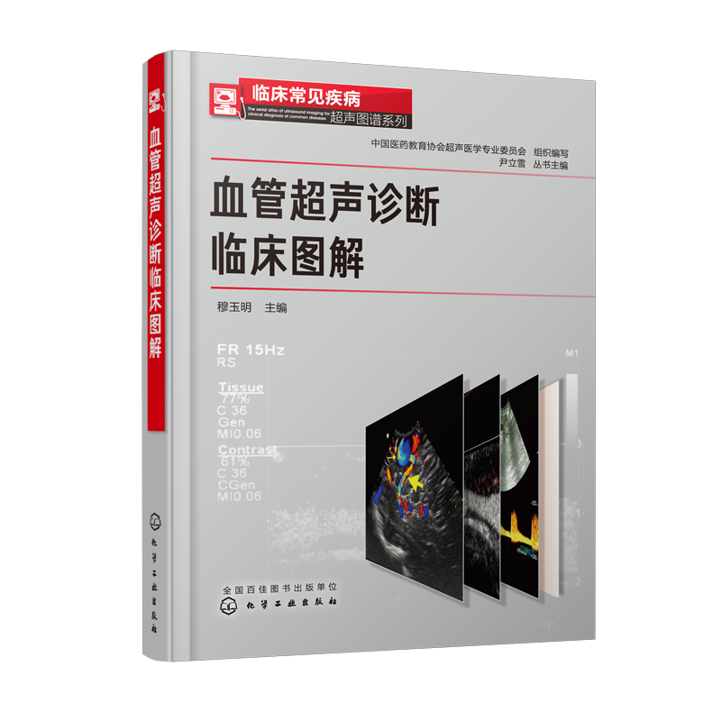正版书籍血管超声诊断临床图解穆玉明临床常见疾病超声图谱系列血管