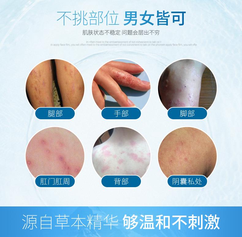 一瓶装贝康镁软膏贝康镁官成人湿痒顽固皮肤止痒规格1