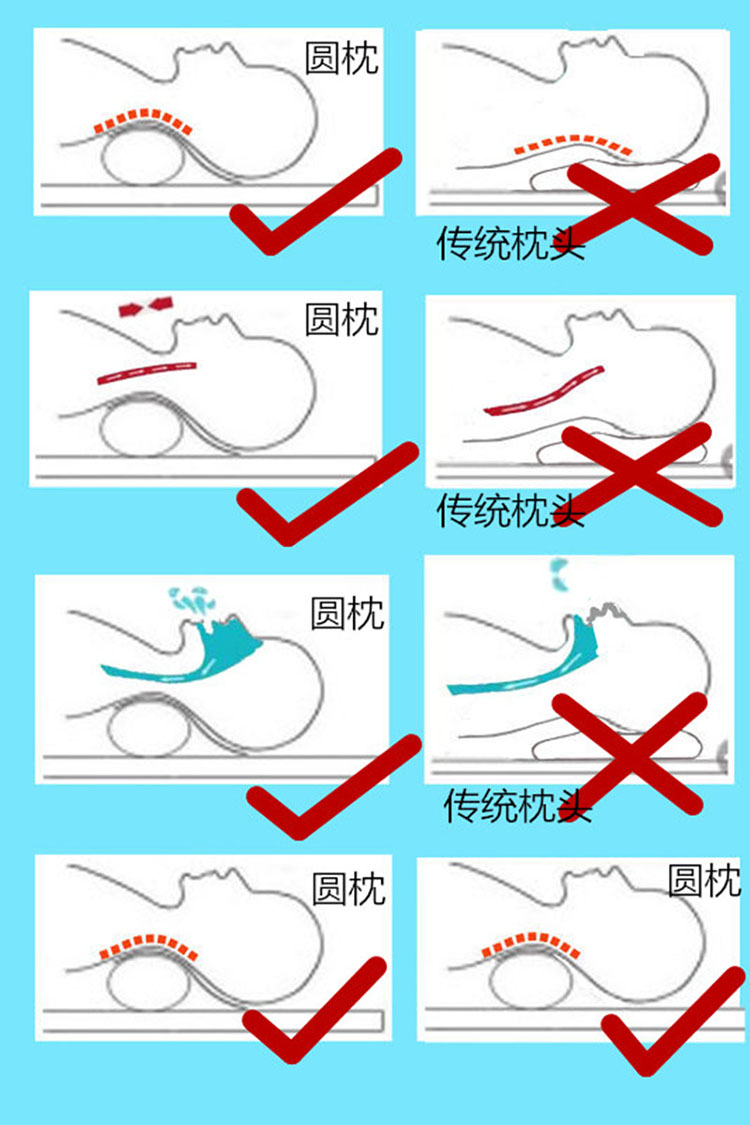 圆柱颈椎枕用法图解图片