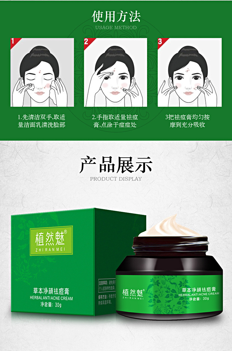 植然魅zhiranmei草本净颜祛痘膏30g温和祛痘修护痘坑淡化痘印植物配方