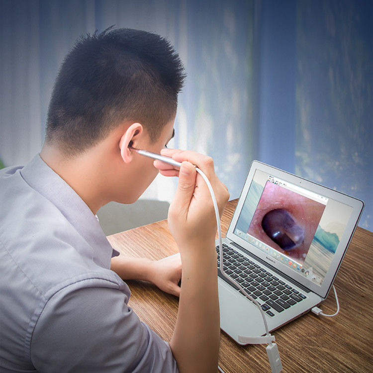 可视耳镜耳勺内窥镜高清挖耳可视耳鼻清洗儿童看牙可视内窥镜wifi版窥