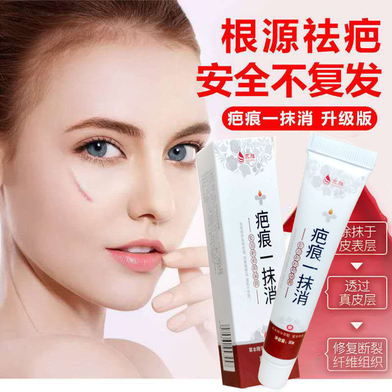 三天淡疤去疤膏修复无痕祛疤膏手术烫伤老疤医用除痘印1支装