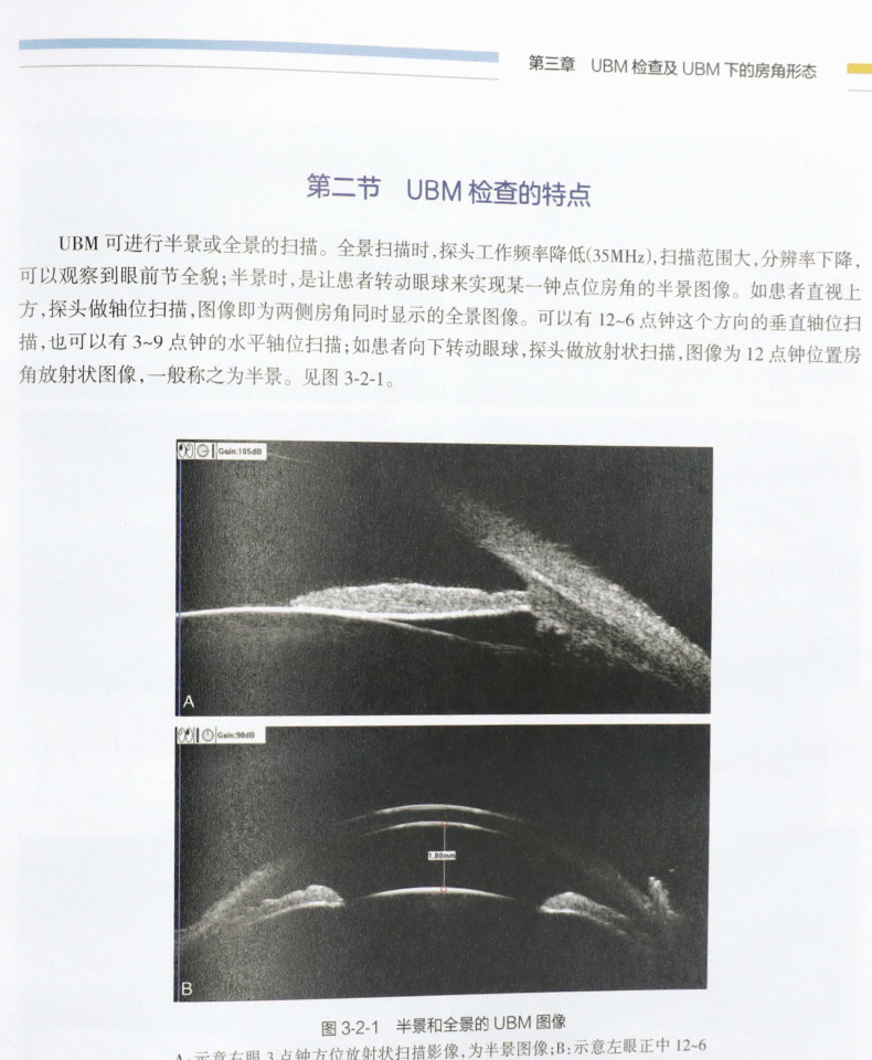 图解青光眼 眼前节影像学检查及诊断 张秀兰 青光眼诊断 房角镜 ubm