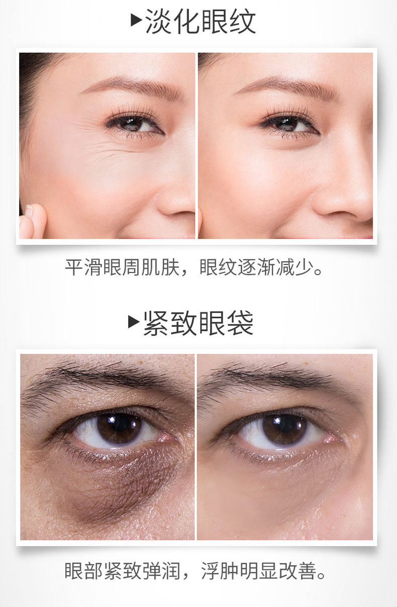 端兰多肽眼部精华眼袋黑眼圈细纹紧致眼霜淡补水保湿精华