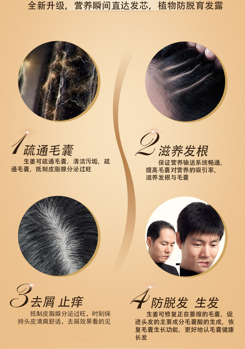 索芙特防脱育发洗发水大瓶600ml控油防脱去屑止痒男女通用