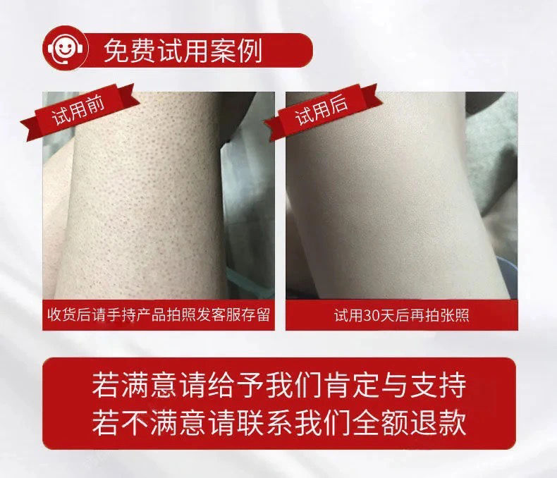 脚长鸡皮疙瘩涂什么药(脚长鸡皮疙瘩涂什么药膏好)