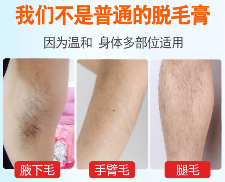 男女士私处去毛膏除腋毛腿毛脱毛部专用私密处永久脱毛膏