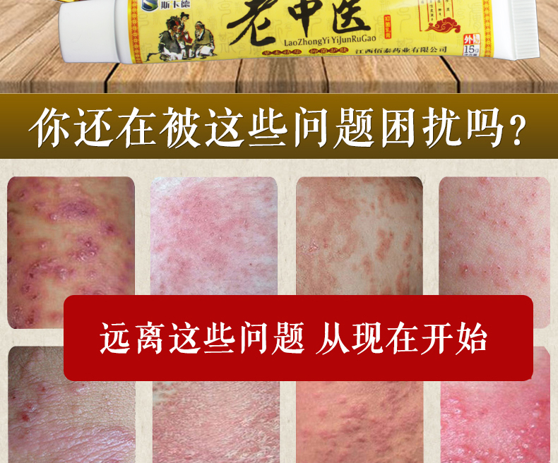 藥膏去腳氣爛腳丫脫皮大腿內側瘙癢股癬癢靈龜頭炎珍珠疹汗皰疹止癢