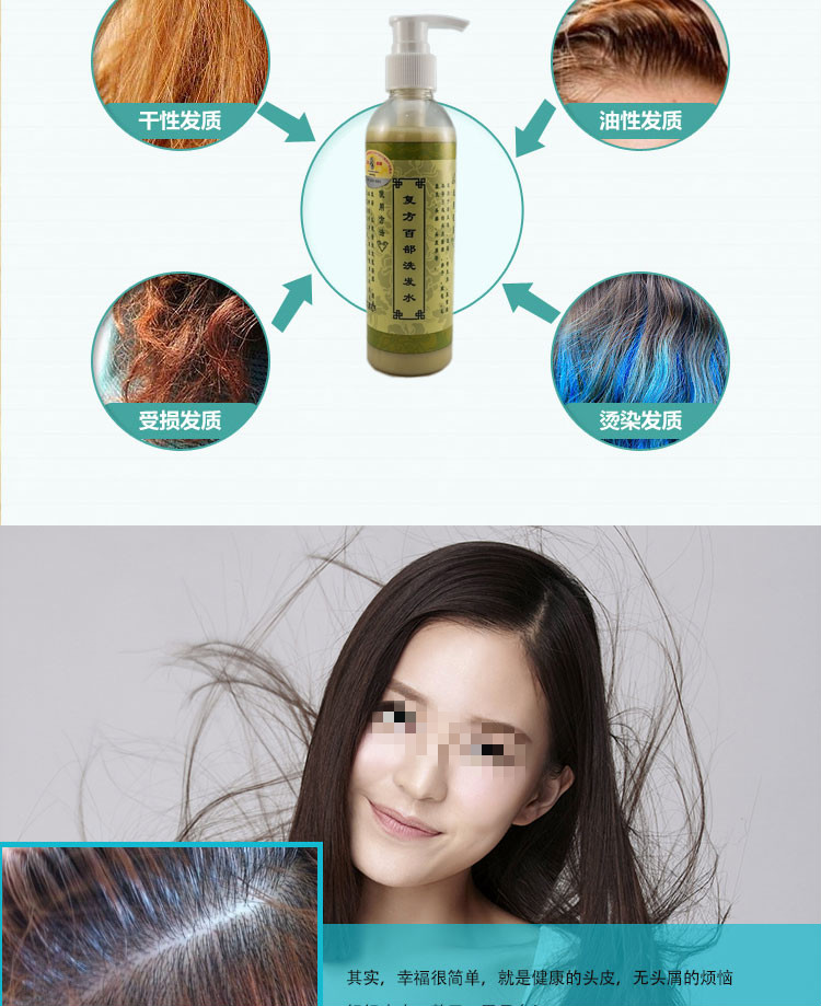 誉芙美香皂 (专营)宫恋 洗水去头屑头痒头皮痒头皮头廯头湿疹去螨虫