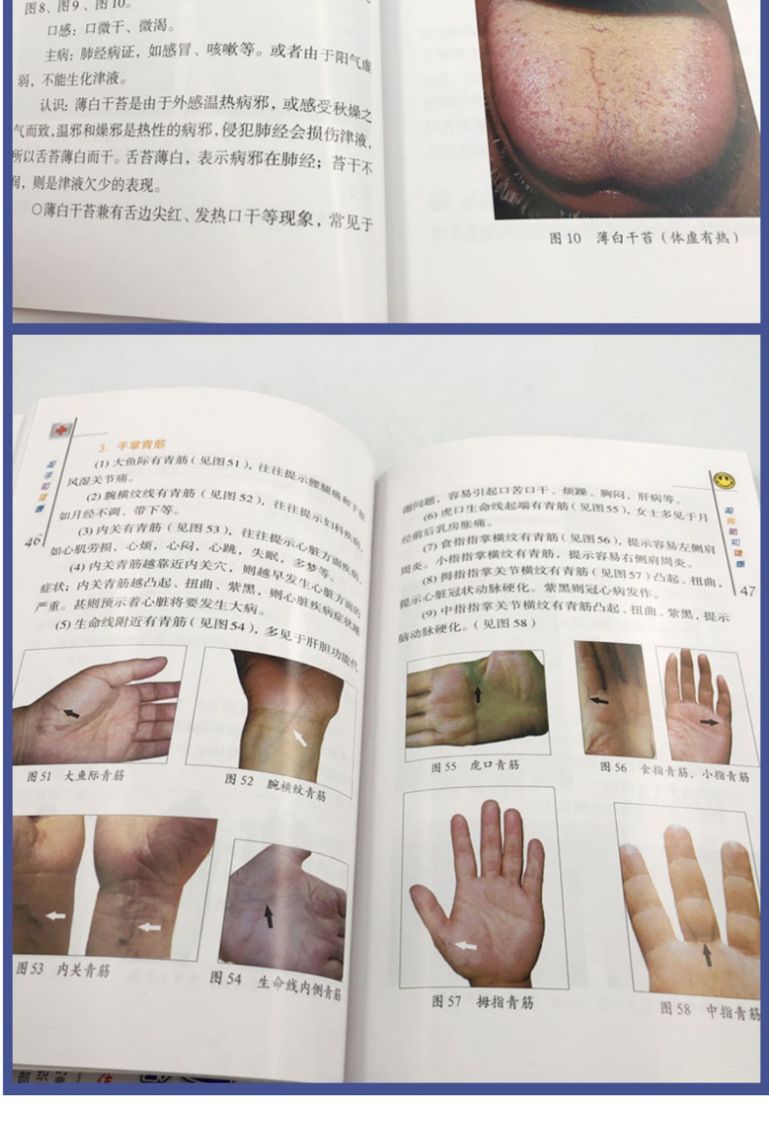 [诺森正版]正版 观手知健康 观舌知健康 蔡洪光著 手诊舌诊书籍完全