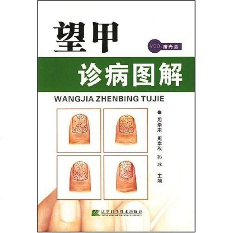 [二手8成新]望甲诊病图解 9787538154016