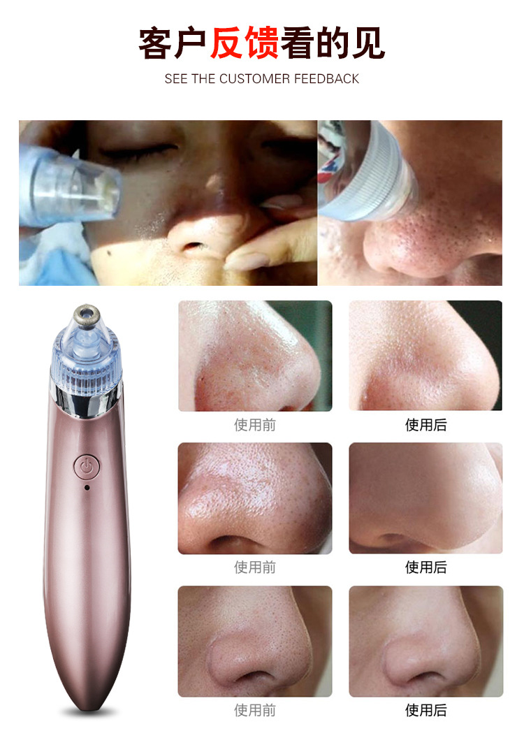 达臣(dacel)除螨仪xn-8030 吸黑头神器电动吸螨虫粉刺去油洁面仪脸部