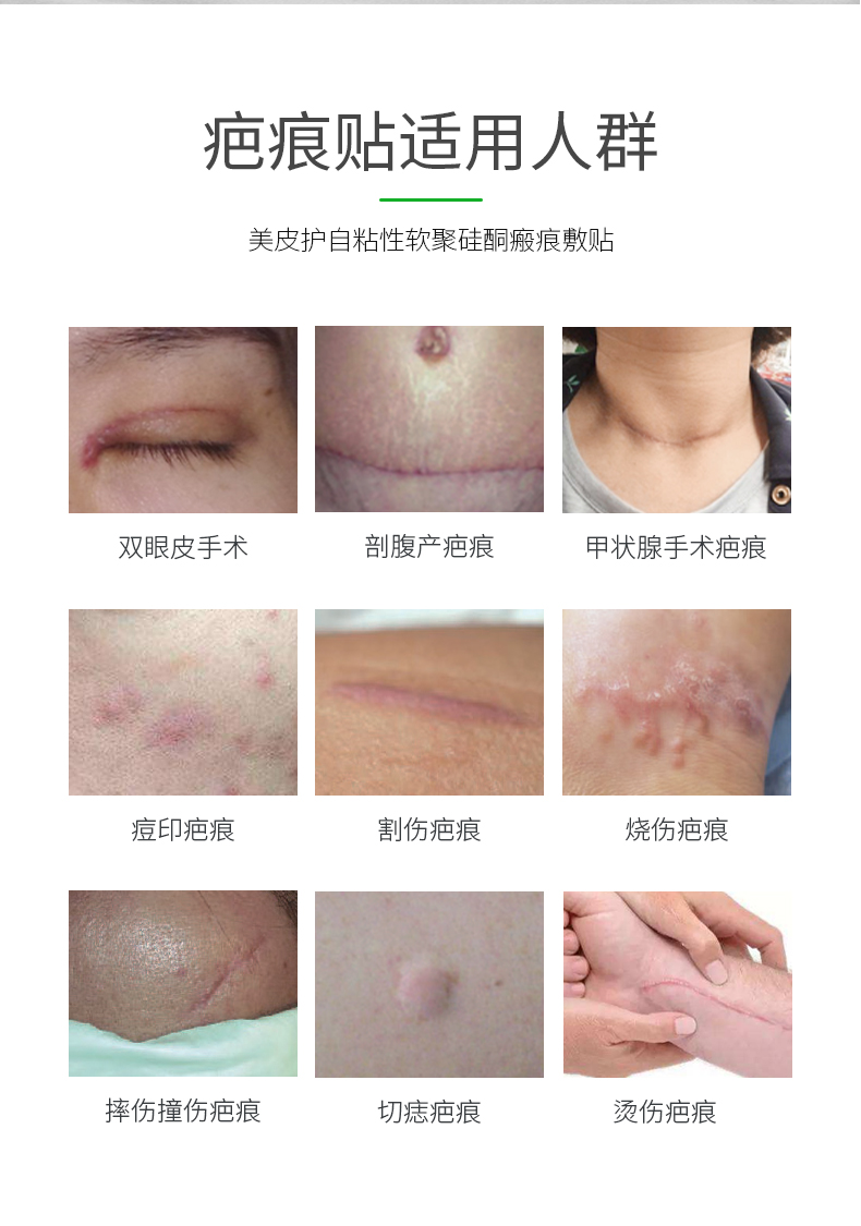 mepiform美皮护祛疤贴祛疤膏外皮去疤膏疤痕修复增生疤痕贴痘印克硅酮