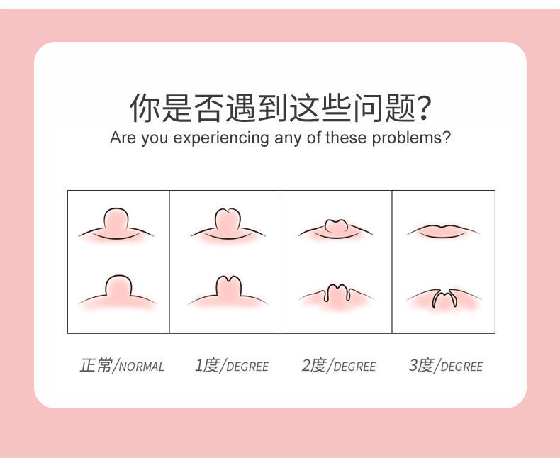乳头内陷纠正器少女学生孕期凹陷扁平短小纠正哺乳期快速吸出喂奶1对