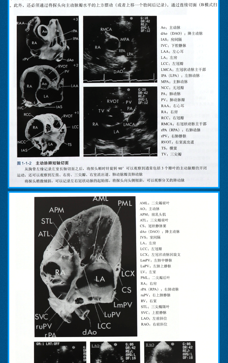 心脏超声精细讲解切面解剖扫查方法与疾病解读中文翻译版影像医学超声