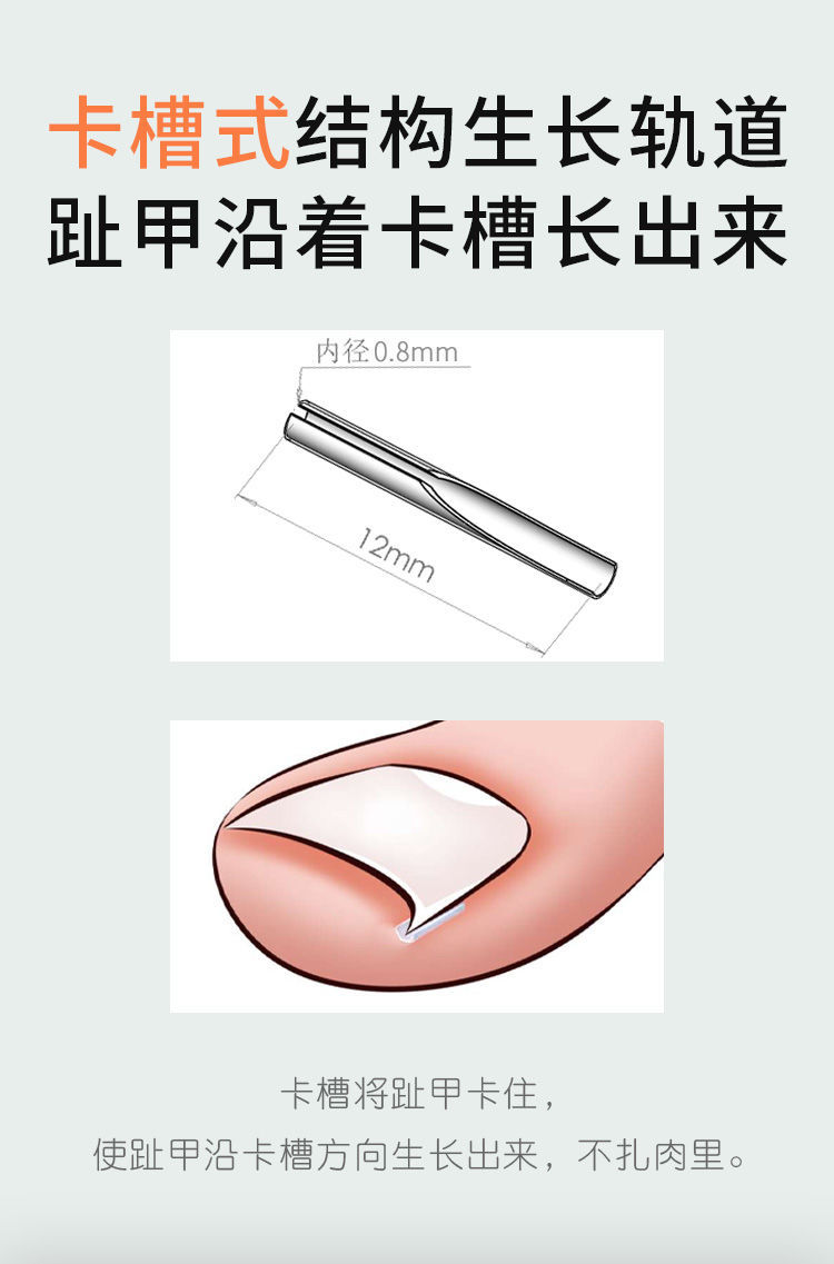 指甲垫脚指甲填充垫片甲沟嵌甲矫正器正甲贴垫趾甲长肉里炎工具 隔离垫20个(薄趾甲用-体验款)