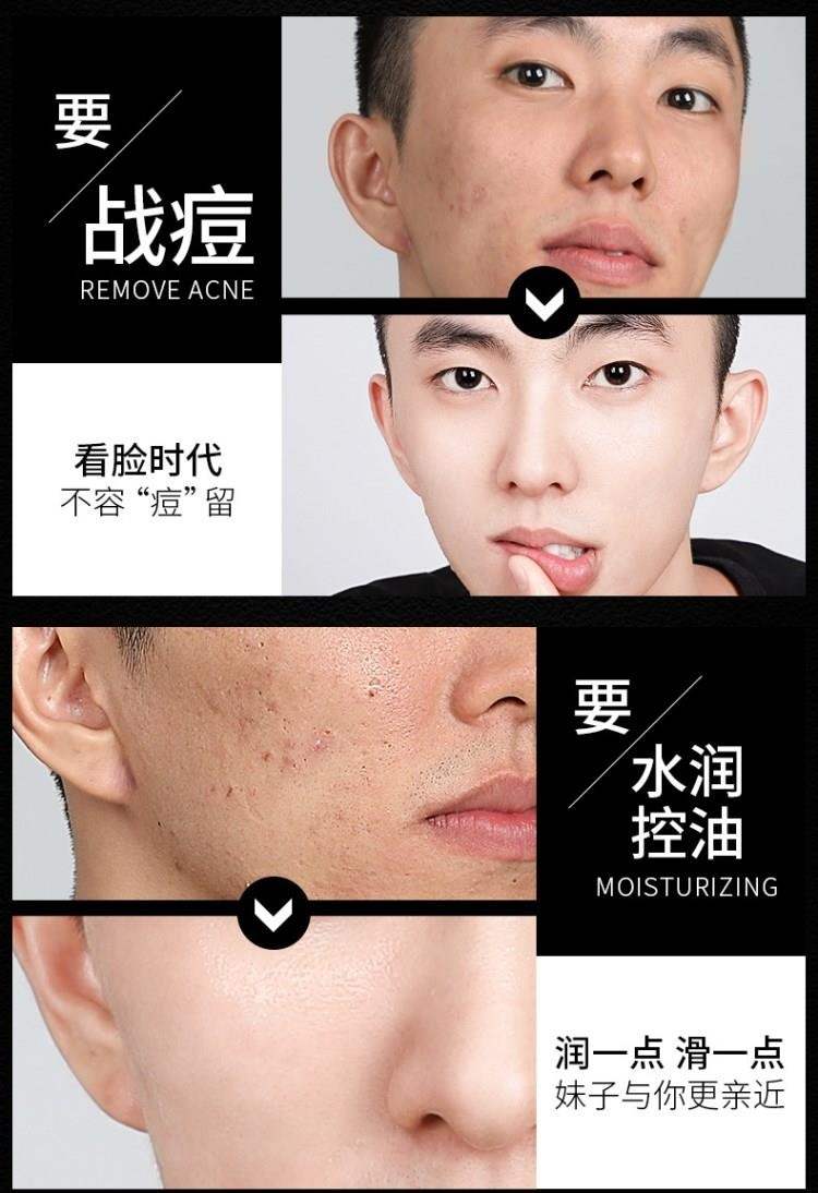 男士面膜控油补水增白除皱纹抗皱男用土专用祛痘紧致去皱纹